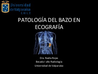 PATOLOGÍA DEL BAZO EN ECOGRAFÍA.